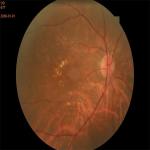 Autofocus Ultra Wide Field Fundus Camera 3.3mm Non Contact