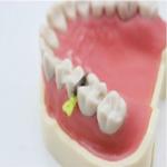 Medical Wedge Guard High Quality Disposable Dental Plastic Wedge Guard