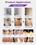 Pico Tattoo Removal Q Switched Picosecond Laser Machine 1064nm Skin Rejuvenation