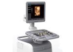 4D Color Doppler Trolley Portable Ultrasound Scanner Fast Light Quiet Smart