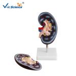 Medical Human Anatomical Model Plastic Kidney Anatomy Model 2 Parts VIC-310-2