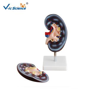 Quality Medical Human Anatomical Model Plastic Kidney Anatomy Model 2 Parts VIC-310-2 wholesale
