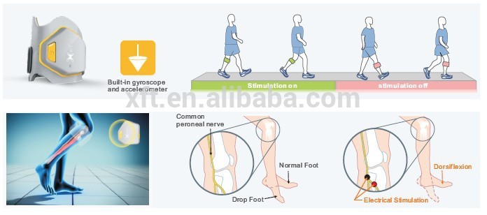 Low Frequency Therapy Device Nerve and Muscle Stimulator for Rehabilitation