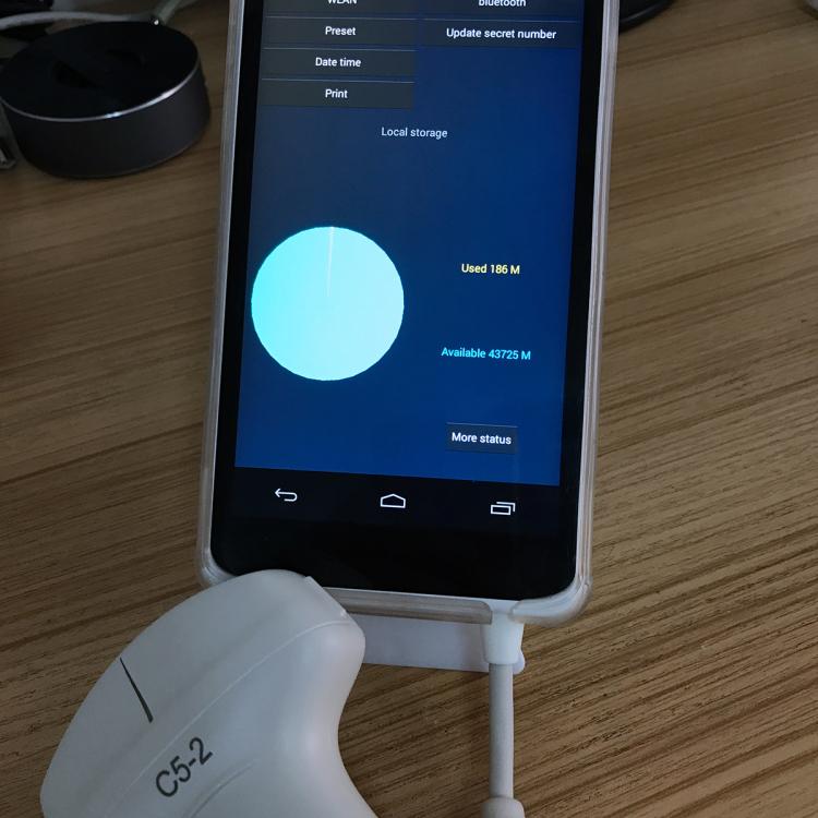 Handheld Ultrasound Scanner convex transducer