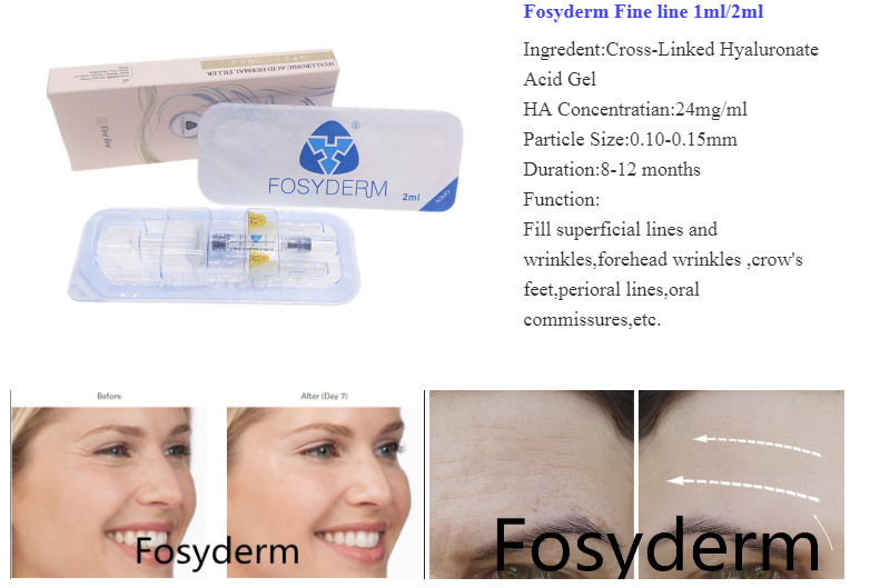 Fosyderm Hyaluronic Acid Injection Face 1ml 2ml 10ml 20ml 50ml Cross Linked