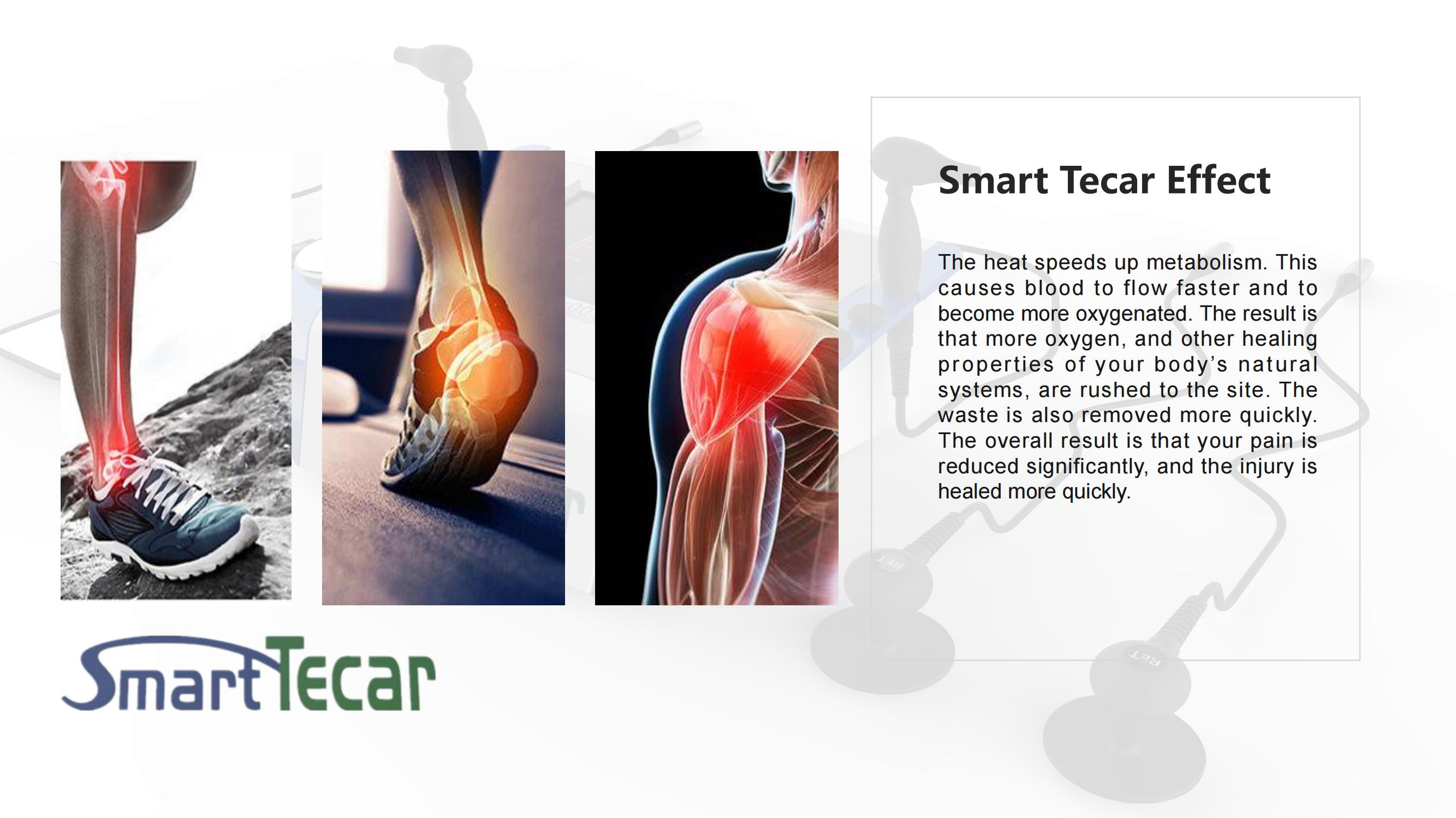 RET CET treatment of muscle recoveryfat burning and fat reductionhigh quality tecar machine shockwave therapy equipment