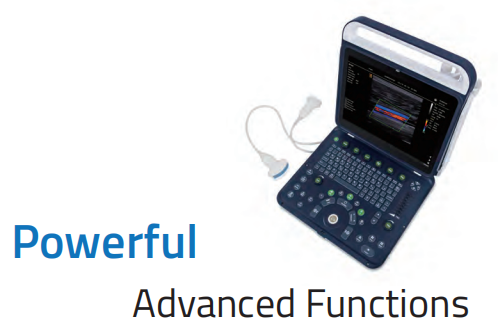 Color Doppler Portable Ultrasound Machine Medical USG PW CW DICOM Cardiac Probe Cardiology for Hospital Clinic