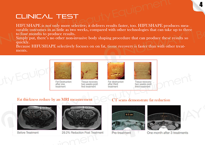 2016 new fat reduction technology Ultrashape/Liposonic/body Slimming Mahcine