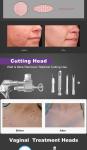 1060nm Fractional CO2 laser Machine Portable CO2 Laser Skin Resurfacing Machine