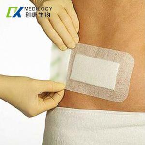 Quality Post Surgical Adhesive Sterile Dressing Fabric Waterproof Transparent Dressing wholesale