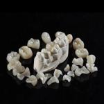Tooth All Porcelain IPS Emax Inlay Onlay Veneer Aesthetic In Dentistry