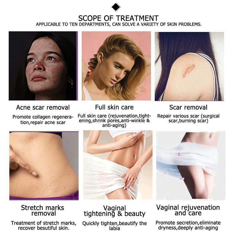 china skin resurfacing machine vaginal scanxel round fotona fractional co2 laser with 3 heads