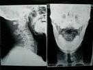 Quality X Ray Medical Imaging Film wholesale
