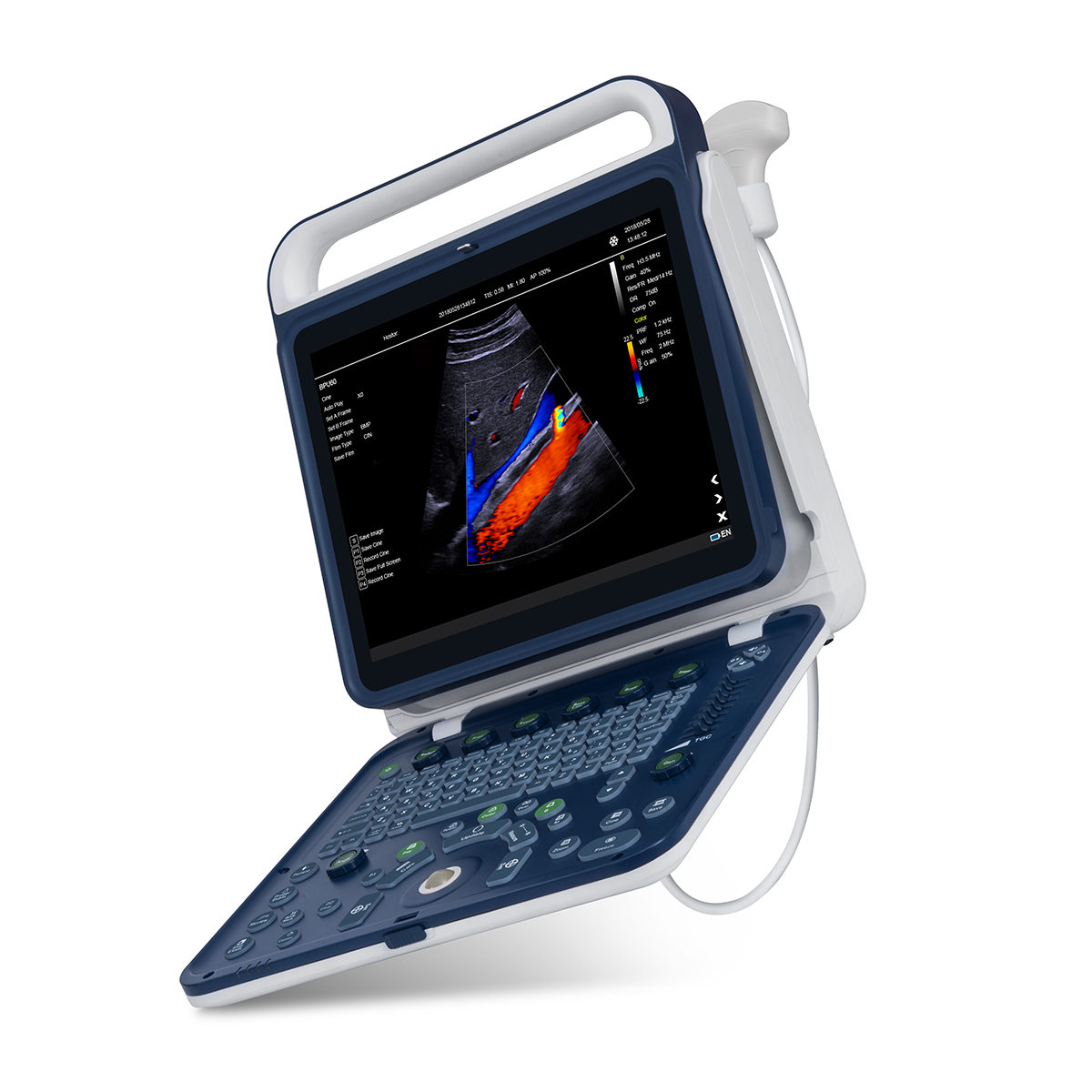 Color Doppler Portable Ultrasound Machine Medical USG PW CW DICOM Cardiac Probe Cardiology for Hospital Clinic