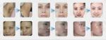 Mini Intense pulsed light ipl hair removal IPL beauty equipment supplier