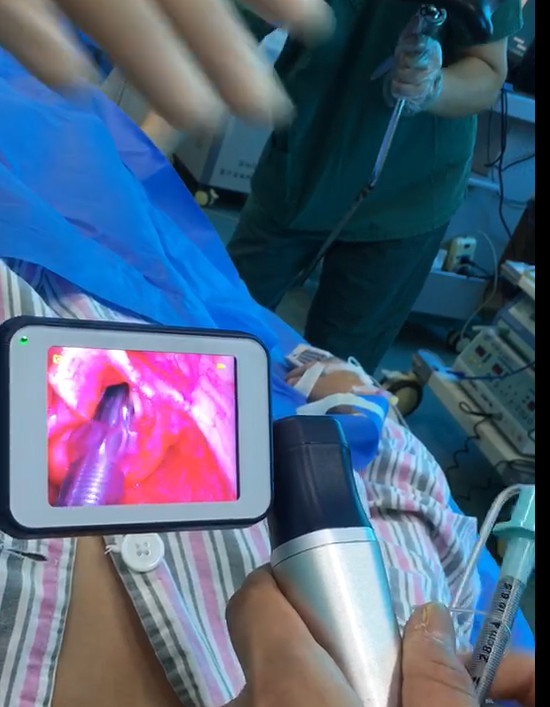 Veterinary use flexible endoscope Fiber Optic Anesthesia video laryngoscopy difficult airway pediatric neonate