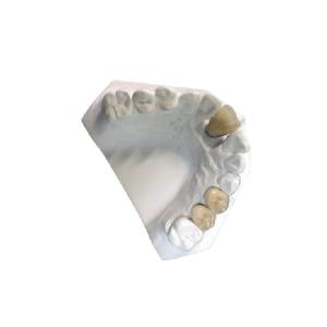 Quality Yellow Gold Porcelain Dental Crown Lab High Strength PFM Ceramic Crown wholesale