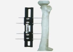Quality Medical External Fixator of bone lengthening, light and easy to do the operation wholesale