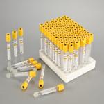 CE ISO Vacuum Blood Collection Tube with Coagulant and Separation Gel 2ml 8ml
