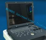 Hot Color Doppler Ultrasound Diagnosis System