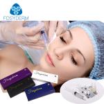 Safety Hyaluronic Acid Lip Fillers 2ml , Lip Plumping Injections Dermal Filler