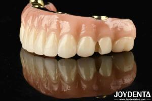 Quality Transform Your Dental Restoration With Ti-Bar Zirconia Hybrid Bridge Durable And Long-Lasting wholesale