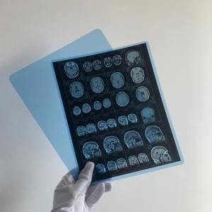 Quality Medical X Ray Dry Film Medical X Ray Inkjet Film With Clear Image Quality wholesale