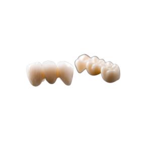 Quality Composite Fixed Bridge Crown Dental Crown Bridge Natural Color Good Stability wholesale