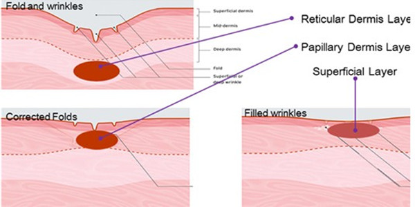 CE approval Fractional Rf Microneedle quipment for Wrinkle Removal Face Lift, Skin Rejuvenation, Scar removal