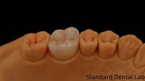 Quality Noritake Porcelain Full Contour Zirconia Crown Customized Vita Shade for Esthetic Digital Dental Restoration by Dental Lab wholesale