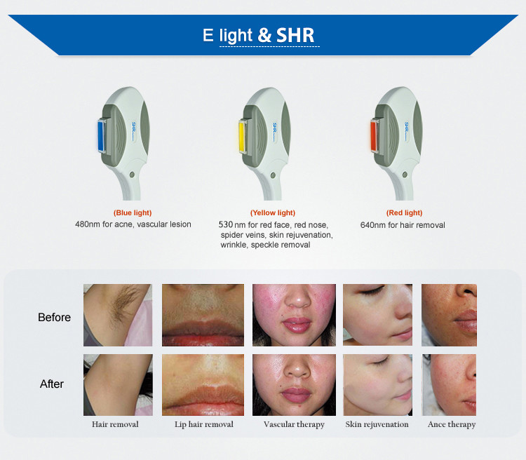SHR OPT Commercial Laser Hair Removal Machine Salon Skin Rejuvenation Machine