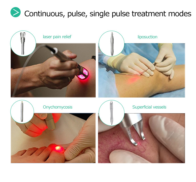 Portable Toenail Fungus 100ms Vein Removal Laser Machine
