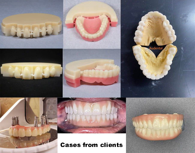 Audental OEM/ODM Denture Material Dental Material Cadcam Dental PMMA Block