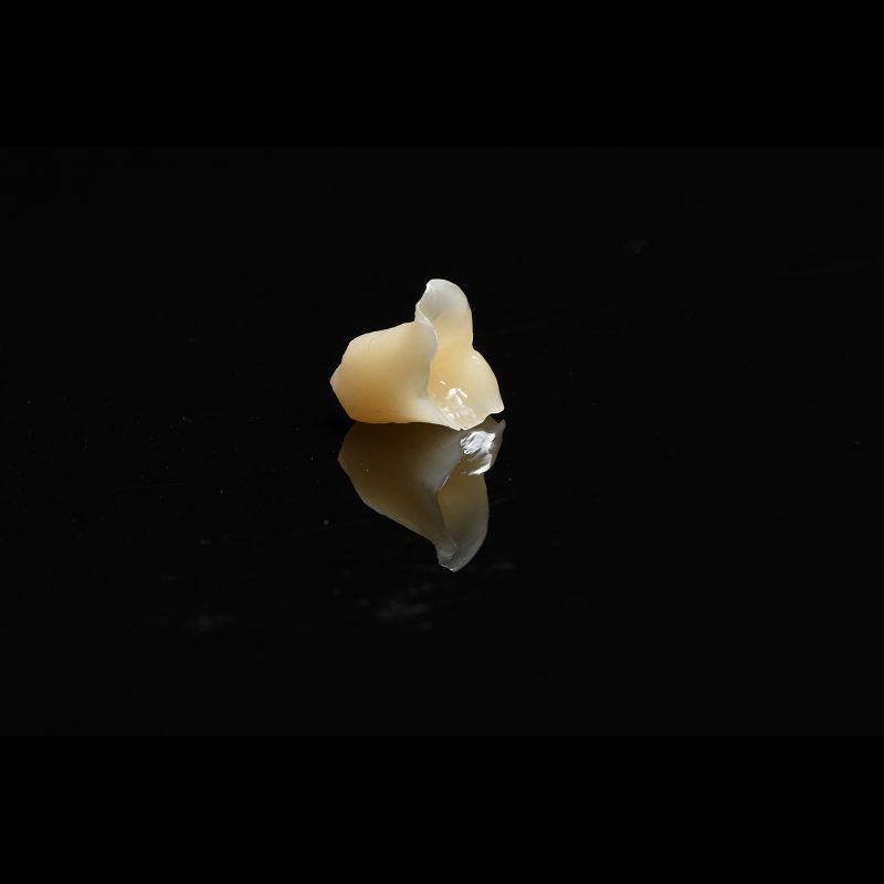 Metal Free Composite Crowns Inlays And Onlays Bridges Implants ODM