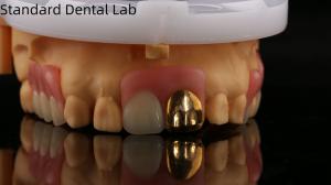 Quality Full Acrylic Dentures With Yellow Gold Teeth/Dental Temporary Acrylic Denture Ivoclar Professional FDA Approved wholesale