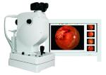 Non - mydriatic Retinal Fundus Camera 9 Focusing Dots Ultrahigh Pixel