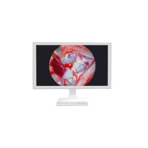 Quality FHD Medical Equipment 22 24 27 Inch Endoscope Camera Monitor Display Full HD Medical Monitor wholesale