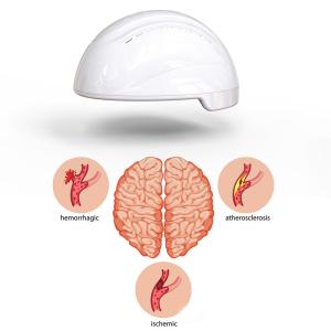 Quality RTMS PBM Photobiomodulation Helmet wholesale