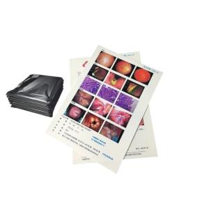 Quality PET Film Base Blue Transparent Color Medical X ray films for X-ray Diagnosis wholesale