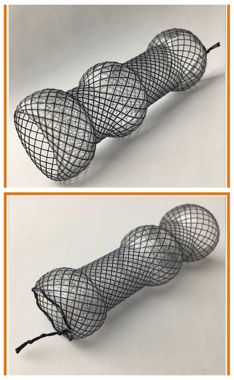 medical nitinol alloys esophageal stent