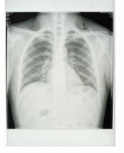 Quality Custom 25cm * 30cm White Base Xray Paper Medical Film with PET materials wholesale