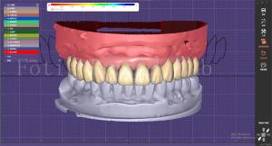 Quality Dental Teeth Design Service With Prosthesis Planning And Oral Implant Designs wholesale