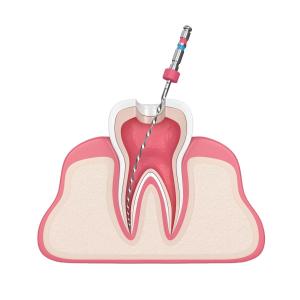 Quality BS Blue Storm Rotary Root Canal Files Dental Endo Files wholesale