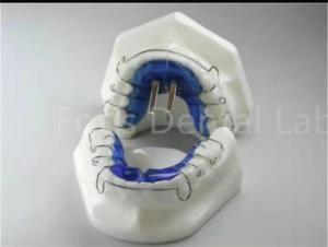 Quality Orthodontic Treatment Retainer Expander For Precise Teeth Alignment wholesale