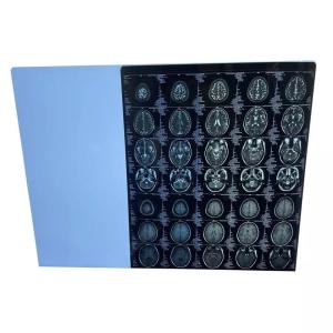 Quality Anti Static Medical Dry Film Fuji Laser Imaging Film 25cmx35cm wholesale