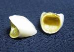 Strong Cosmetic PFM Porcelain Fused Metal Crown Colour Stability
