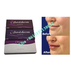 Quality Voluma Hyaluronic Acid Fosyderm Dermal Filler Injection 24mg/Ml wholesale