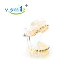 Oral Orthodontics Stainless Steel Self Ligating Brackets 0.022'' 0.018''