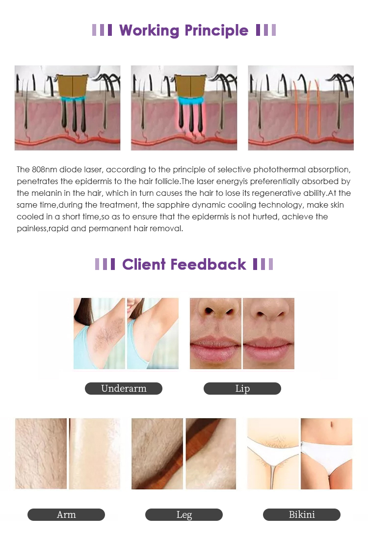 Professional Laser Hair Removal Machine 755 808 1064Nm Beauty Laser Hair Removal Instrument