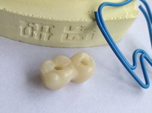 Quality CAD CAM Design Dental 3D Print wholesale